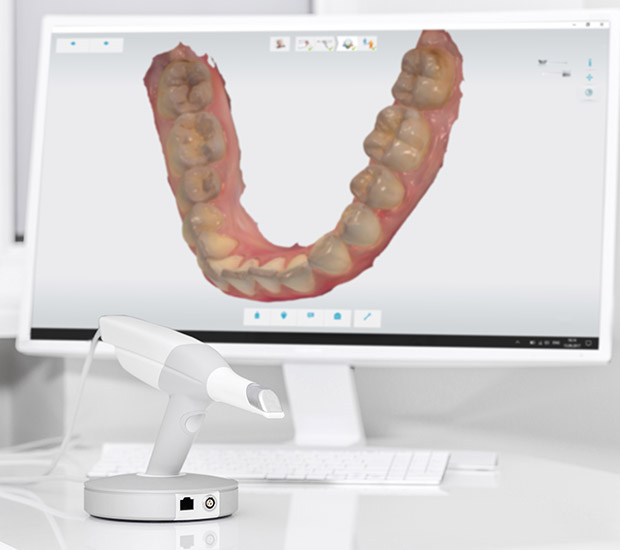 Oak Brook 3D Cone Beam and 3D Dental Scans