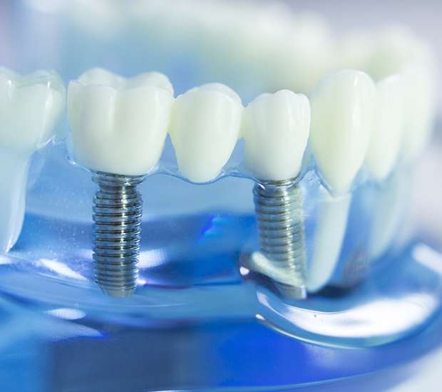 Oak Brook Dental Implants