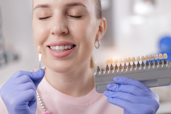Questions To Ask Before Getting Dental Veneers