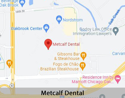 Map image for Partial Dentures for Back Teeth in Oak Brook, IL