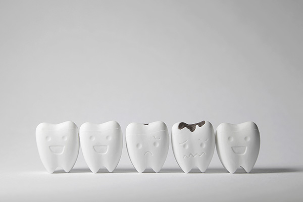 How a General Dentist Can Treat Tooth Decay from Metcalf Dental in Oak Brook, IL