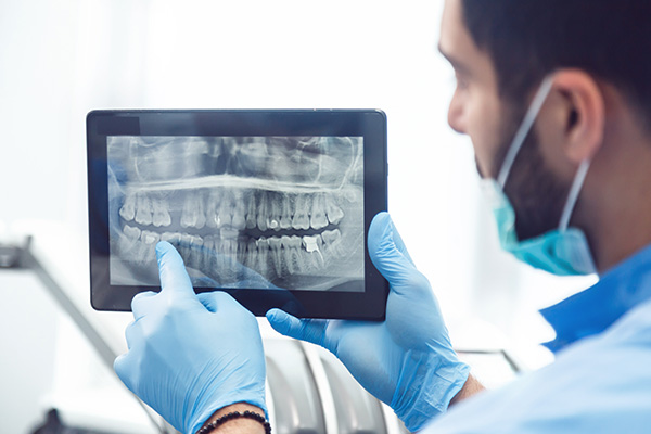 General Dentistry: Are Dental X-rays Recommended? from Metcalf Dental in Oak Brook, IL