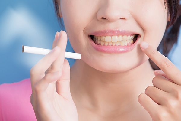 General Dentistry: How Smoking Can Harm Your Teeth from Metcalf Dental in Oak Brook, IL