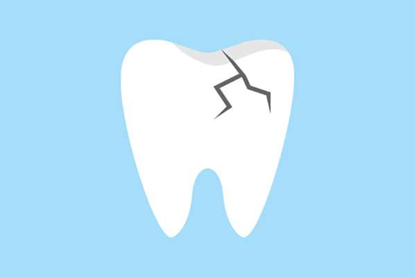 General Dentistry Treatments for a Damaged Tooth from Metcalf Dental in Oak Brook, IL