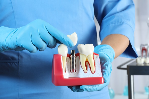 How Restorative Dentistry Can Transform Your Dental Health